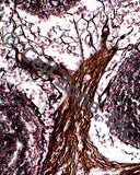 PST-fun-2 (reticular connective tissue that looks like a tree)