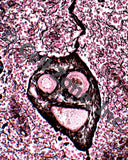 PST-fun-1 (reticular connective tissue that looks like a face)